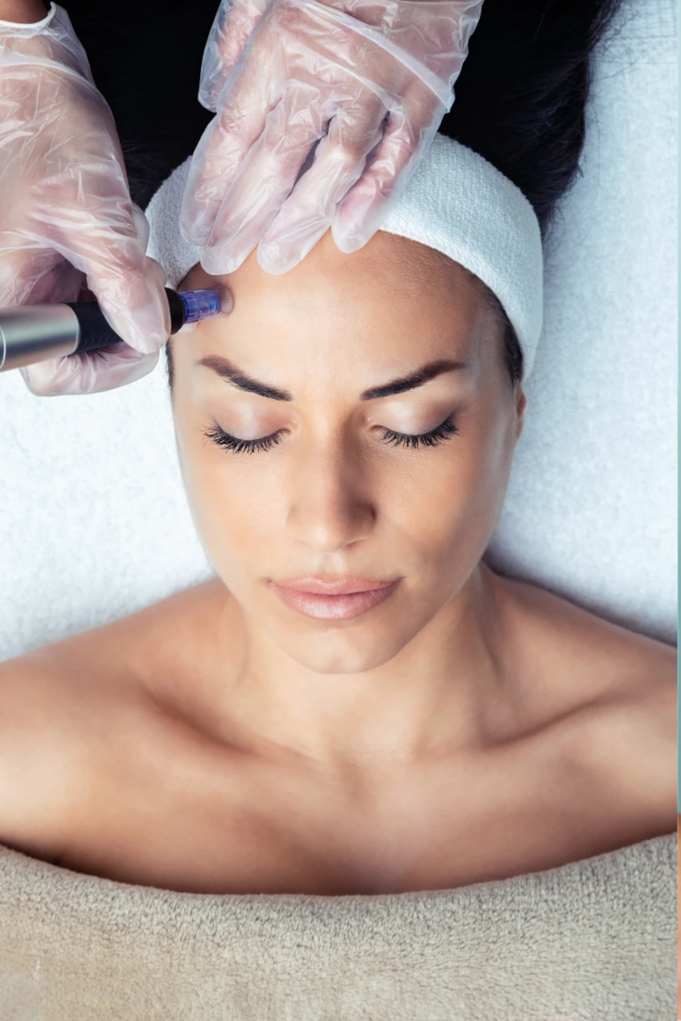 dermal fillers